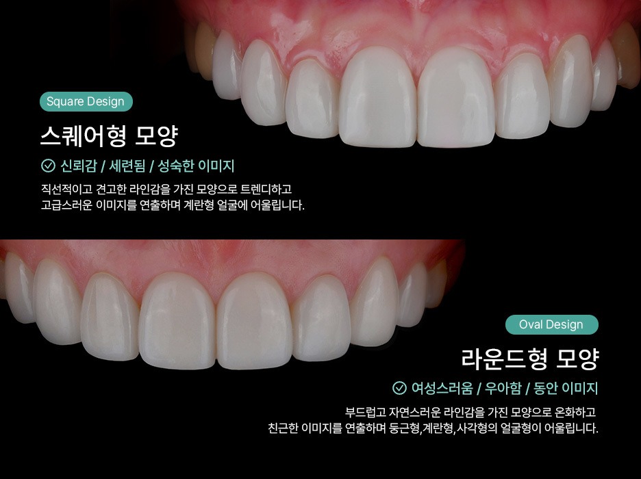 치아 앞니 근접 컷