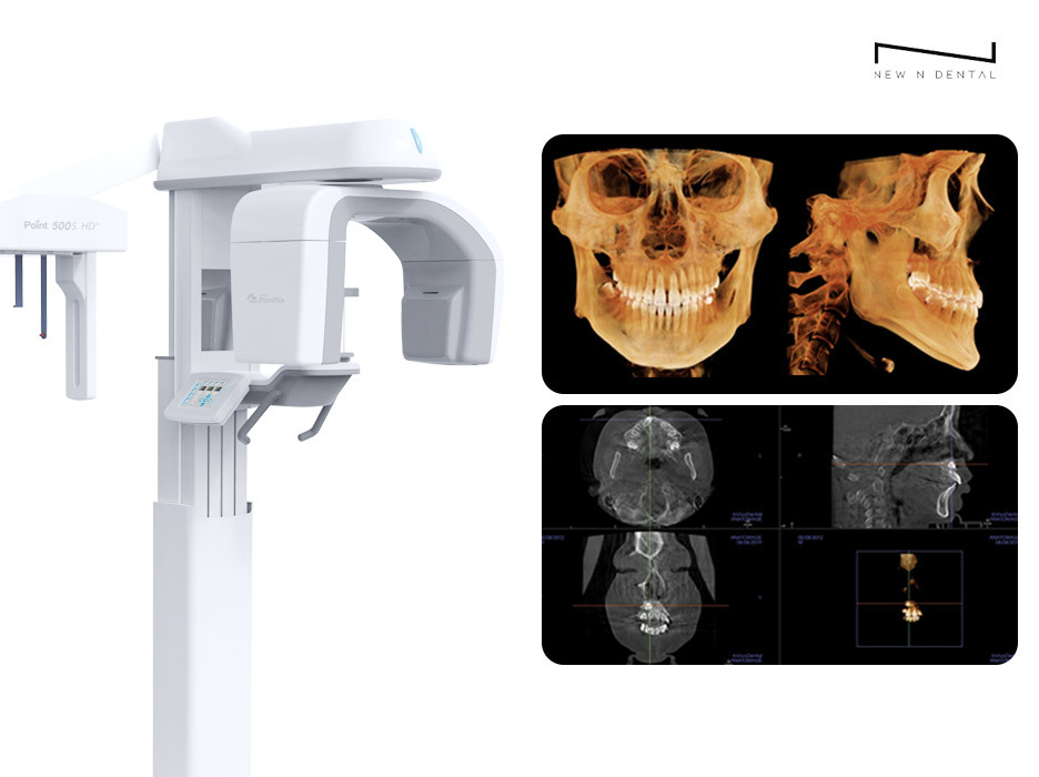 3D CBCT 촬영 장비